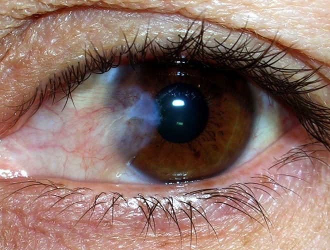 Las-cataratas-oculares-y-el-cuidado-visual-oh-my-boomer